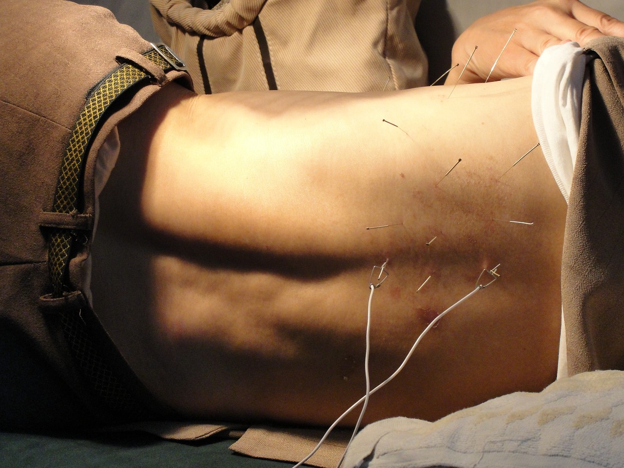 Jak działa akupunktura? Wyjaśnienie mechanizmu działania i naukowe dowody.